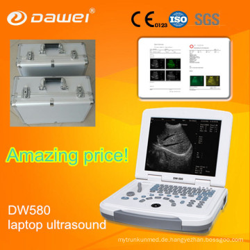 Laptop Tierarzt Ultraschall für Schwein, Schaf &amp; Handheld Palm Ultraschallgerät